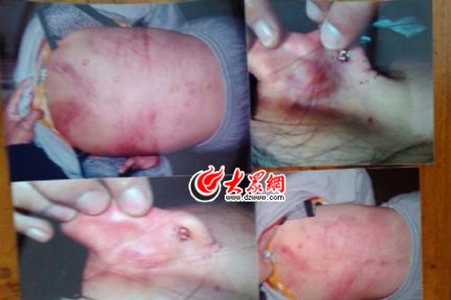 　山東藝術(shù)設(shè)計學(xué)院16歲女生宿舍內(nèi)被女同學(xué)暴打4小時。