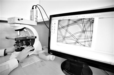 顯微鏡下，聚酯纖維很光亮，表面有斑點，粗細非常均勻。
