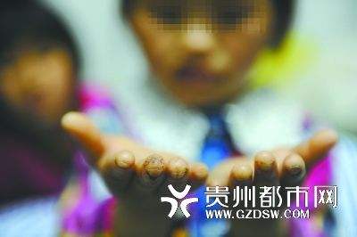 指尖被針扎得傷痕累累。