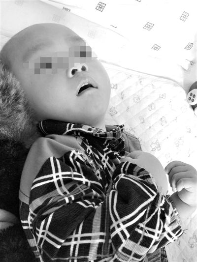 9月10日，陳揚(yáng)躺在醫(yī)院的病床上，他的眼睛仍然沒(méi)有聚焦感。新京報(bào)記者 朱柳笛 攝