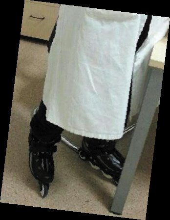 醫(yī)生因醫(yī)院太大蹬輪滑跑會診 忙時一天跑12公里 醫(yī)生因醫(yī)院太大蹬輪滑跑會診 忙時一天跑12公里