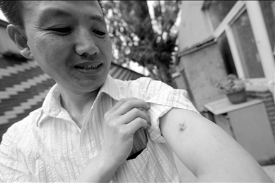 郭學(xué)江制服狂徒時(shí)被咬傷。京華時(shí)報(bào)記者潘之望攝