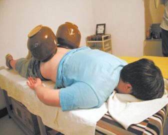 拔泡菜壇子火罐。