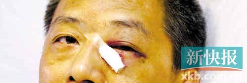 ■這起醫(yī)鬧事件，受傷的遠(yuǎn)遠(yuǎn)不只是熊旭明醫(yī)生的身體。