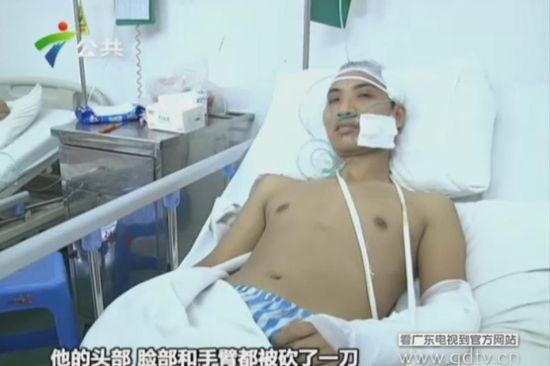 另一名傷者頭部、臉部和手臂都被砍了一刀。(視頻截圖)