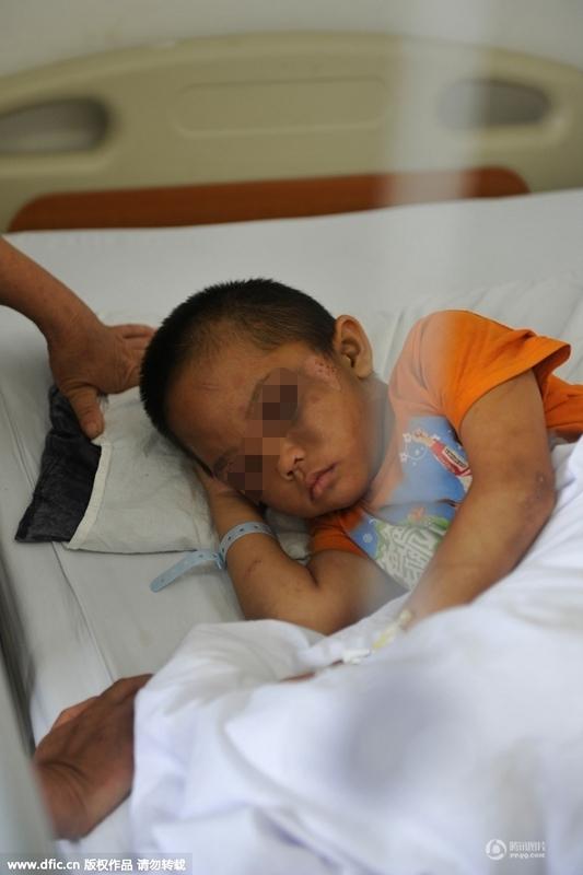 圖為全身傷痕累累的小進(jìn)。