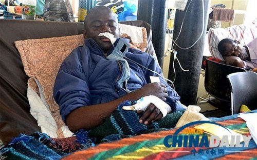 雖然已經(jīng)在醫(yī)院接受了近一個月的恢復治療，卡托卡的身體仍然非常虛弱。