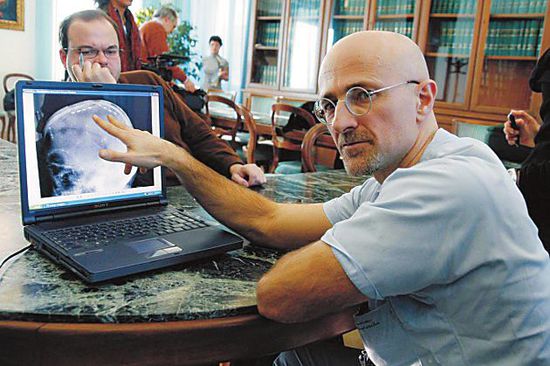 圖為卡納維洛醫(yī)生，不少人認(rèn)為他的想法非常瘋狂