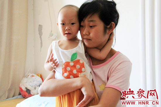 孩子和媽媽在一起，她的右眼已經(jīng)失明。