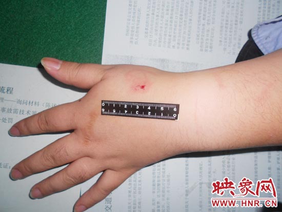 為幫助無(wú)證駕駛的朋友逃避處罰，新鄉(xiāng)的王某竟對(duì)執(zhí)勤民警大打出手，還將一名民警的手臂咬傷