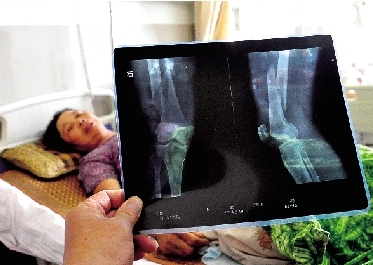 女環(huán)衛(wèi)工不慎墜入人行道深坑 施工方匆匆填坑回應含糊