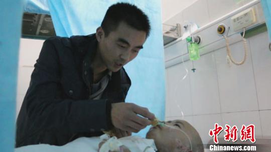 河南掉油鍋重傷女童4次植皮已轉出重癥監(jiān)護室 河南掉油鍋重傷女童4次植皮已轉出重癥監(jiān)護室