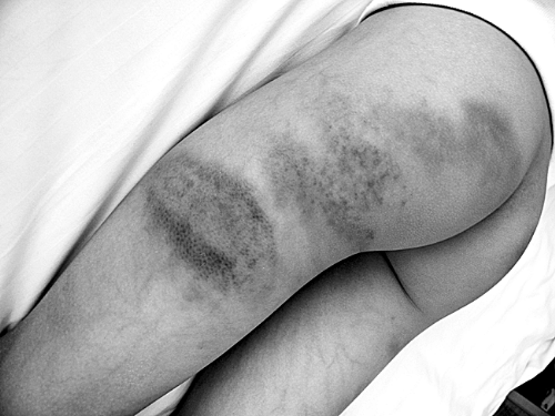 老師持掃帚打?qū)W生30分鐘 一個(gè)班20個(gè)同學(xué)被打過 老師持掃帚打?qū)W生30分鐘 一個(gè)班20個(gè)同學(xué)被打過