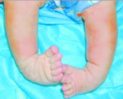 媽媽怕伢走路晚 7個(gè)月大就用學(xué)步車(chē)