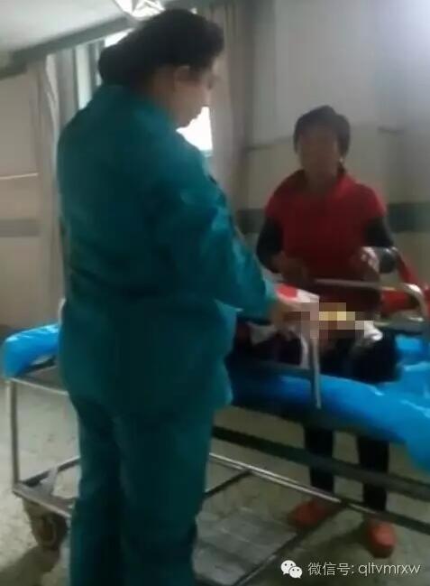 涵涵爸爸告訴《每日新聞》記者：“沒想到是熱水，大人也沒看，一時疏忽，掉進去了。抱出來的時候這個皮已經(jīng)掉了。”