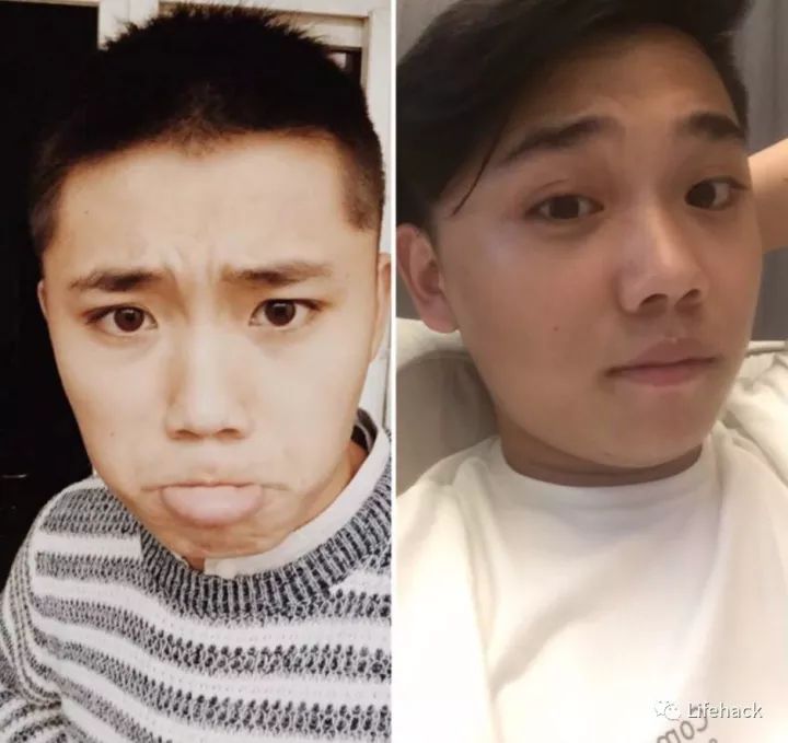 長(zhǎng)胖20斤，臉型怎么變？這些例子看完扎心了！