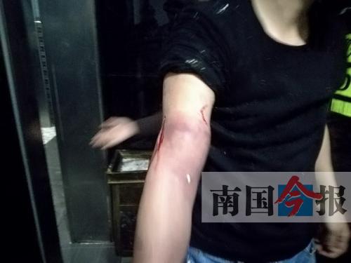 覃先生手臂被卡的部位受傷流血，所幸傷勢(shì)無(wú)大礙。 通訊員 王建民 攝