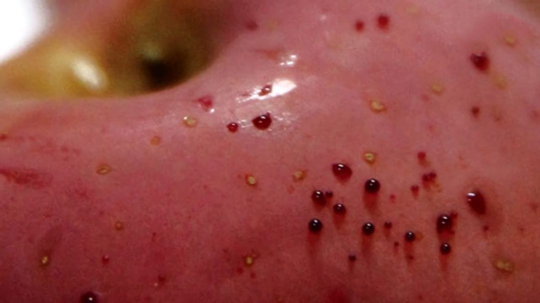 嚇懵！女子用熱水泡蘋果結(jié)果冒出血珠 咋回事？