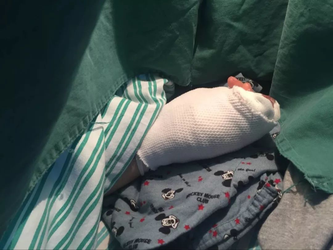 嚇哭！6歲男孩被夾斷手指 罪魁禍?zhǔn)拙故切７? oldsrc=