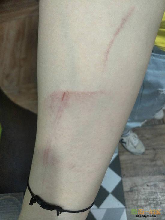 女網(wǎng)友舉報(bào)網(wǎng)帖中出示的被打后照片。