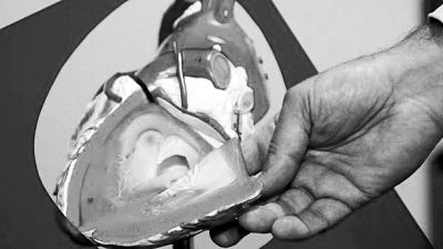 威廉斯領(lǐng)導的研究團隊已經(jīng)利用人體脂肪干細胞，成功3D打印出心臟血管和心臟瓣膜，待一顆心臟的所有部件打