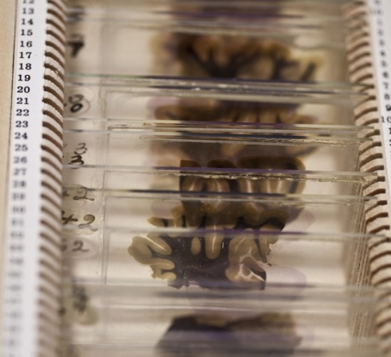 愛(ài)因斯坦大腦切片