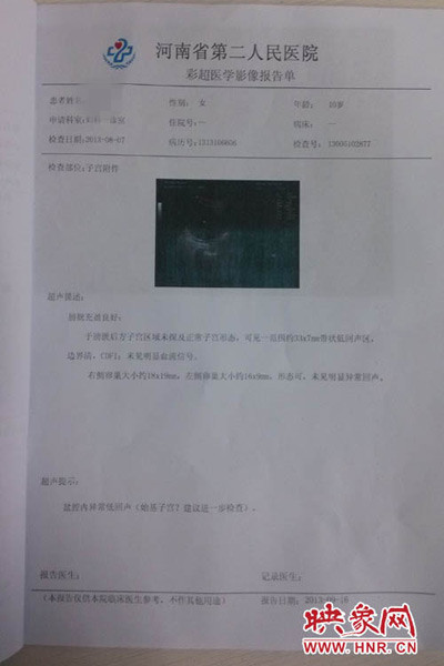 省二院彩超影像報(bào)告 省二院彩超影像報(bào)告