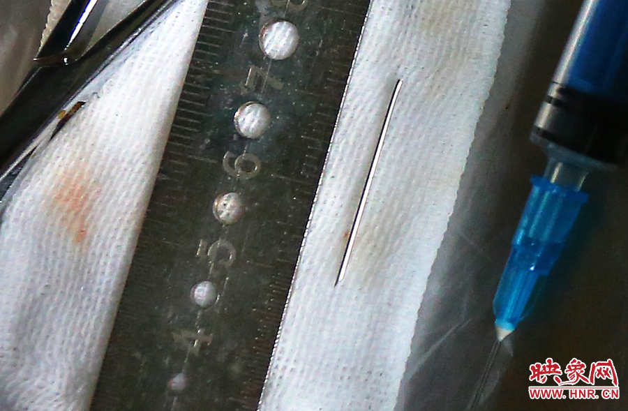 上午11點(diǎn)42分，大龍顱內(nèi)的鋼針被取出