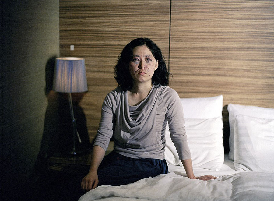 韓攝影師鏡頭記錄患者整容術(shù)后的生活 韓攝影師鏡頭記錄患者整容術(shù)后的生活