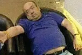 網(wǎng)傳金正男中毒后的照片。