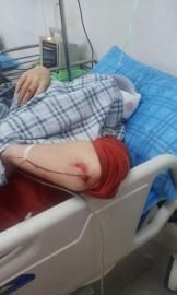 砸窗當(dāng)事人胡女士在醫(yī)院接受治療。