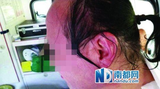 涉事教師遭熱水潑臉后的照片。