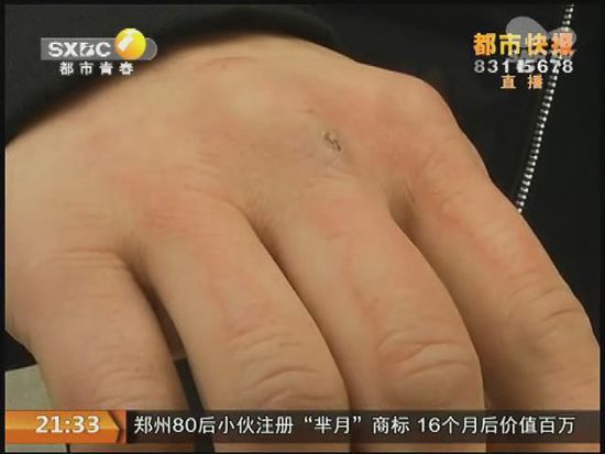 說到這足療拔罐，估計大伙都不陌生，但是想起4號晚上的拔罐的經(jīng)歷，呂先生現(xiàn)在想起來，還心有余悸。