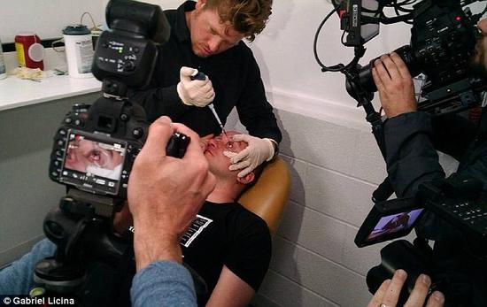 該實(shí)驗(yàn)是由加州一支名為“生物駭客”的實(shí)驗(yàn)團(tuán)隊(duì)開(kāi)展的。他們使用了一種名為二氫卟吩e6（Ce6）的物質(zhì)的溶液。Ce6常見(jiàn)于深海魚(yú)體內(nèi)，有光敏特性，通常用于癌癥治療研究中。研究團(tuán)隊(duì)將Ce6與胰島素和鹽水混合起來(lái)，得到一種溶液，可以在低光照條件下提高人類(lèi)的視力。