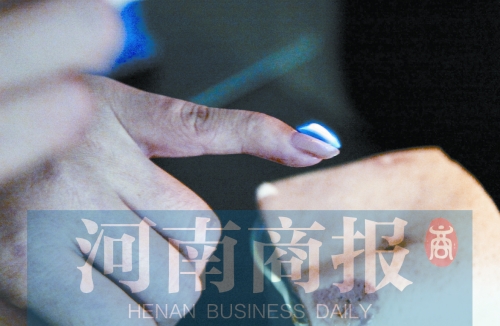 將指甲油涂在指甲上，靠近火焰時被引燃了