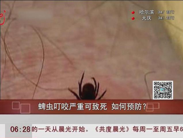 蜱蟲叮咬嚴重可致死如何預(yù)防？