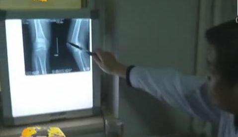 冷空氣來襲 如何預(yù)防老寒腿？